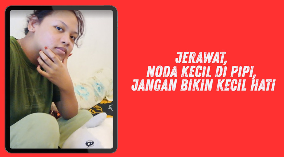 obat jerawat di apotik